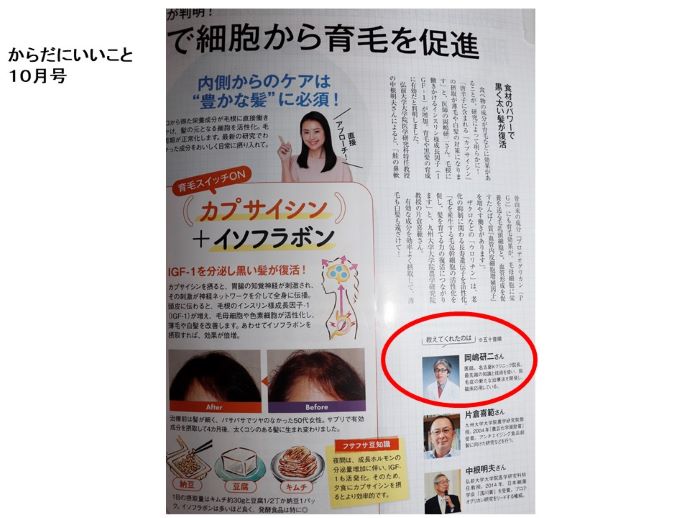 円形脱毛症　病院